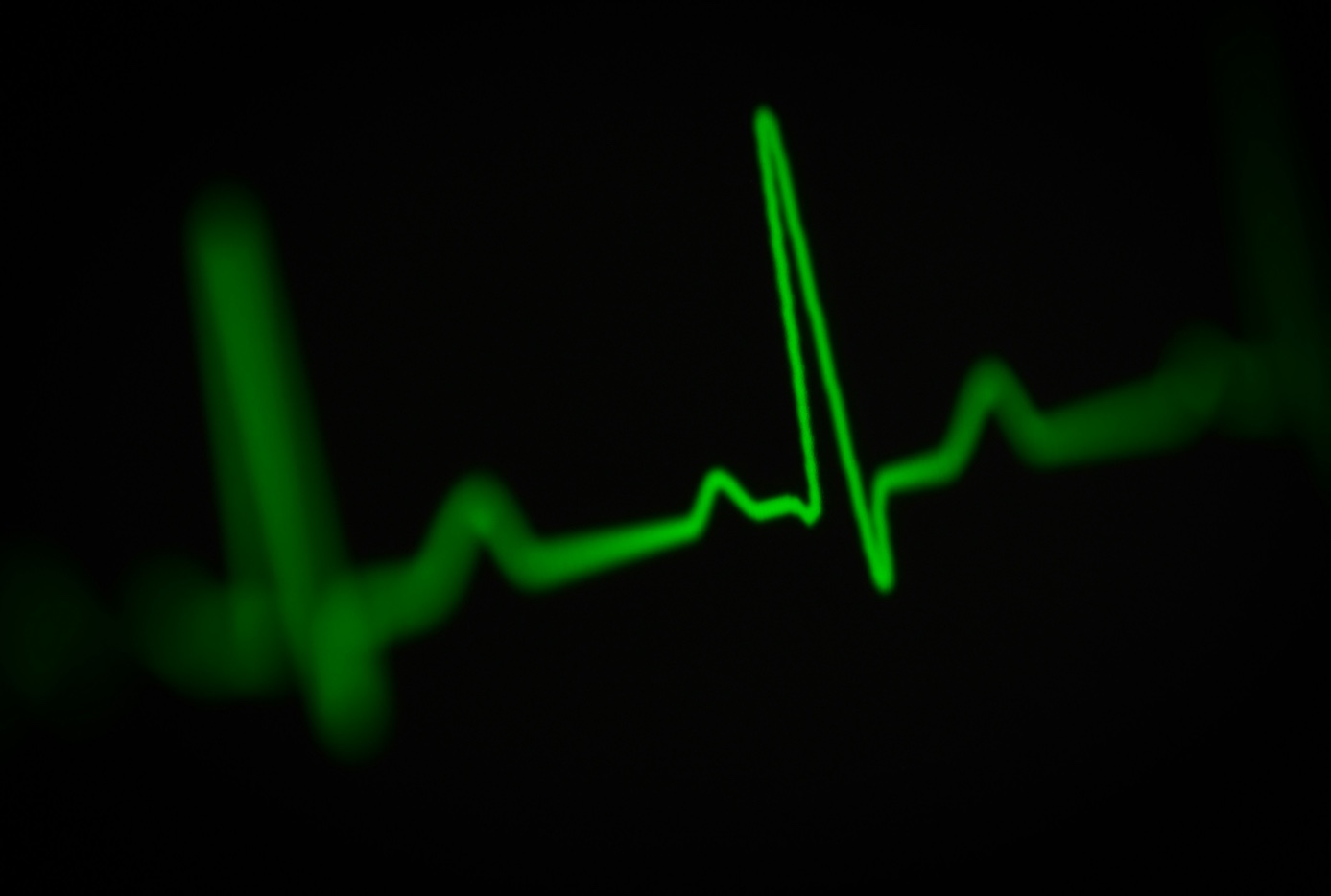 Classifying Myocardial Infarction from ECG Time-Series Data's preview image